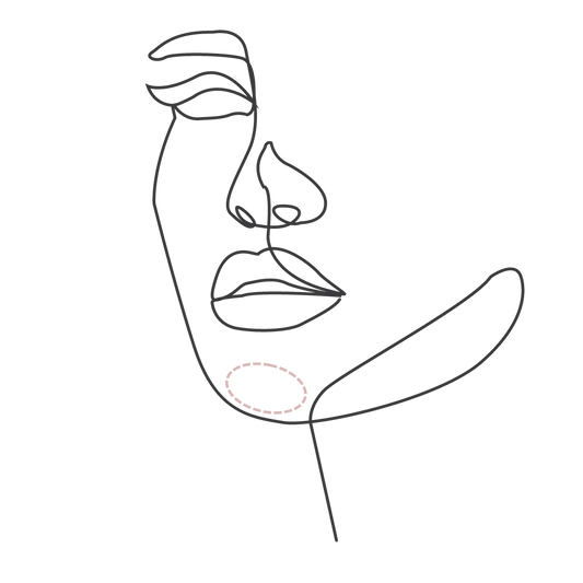 Chin Treatment